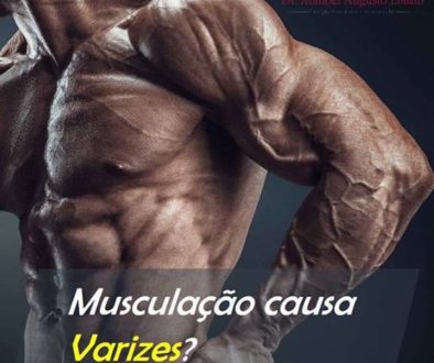 musculacao_causa_varizes